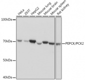 [KO Validated] PEPCK/PCK2 Rabbit mAb (A4466)