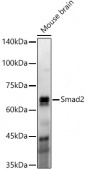 [KO Validated] Smad2 Rabbit mAb (A22635)