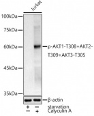 Phospho-AKT1-T308+AKT2-T309+AKT3-T305 Rabbit pAb (AP1266)
