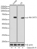 Phospho-Akt-S473 Rabbit mAb (AP1208)
