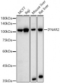 [KO Validated] IFNAR2 Rabbit pAb (A21462)