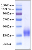Active Recombinant Human IL-2-RA/CD25  Protein (RP00076)