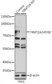 [KO Validated] TRMT2A/HTF9C Rabbit pAb (A19987)
