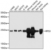 [One Step]RPS3 Antibody Kit (RK05703)