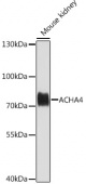 ACHA4 Rabbit pAb (A1648)