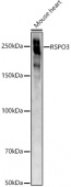 ABCA1 Rabbit pAb (A16337)