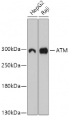 [KO Validated] ATM Rabbit pAb (A18257)
