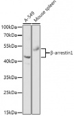β-arrestin1 Rabbit pAb (A0190)