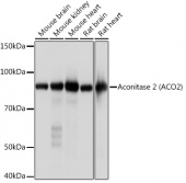 Aconitase 2 (ACO2) Rabbit mAb (A4524)
