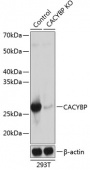 [KO Validated] CACYBP Rabbit pAb (A20004)