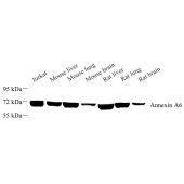 Anti -Annexin-6/ANXA6 Mouse mAb