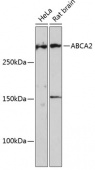 ABCA2 Rabbit pAb (A16735)
