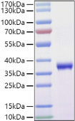 Recombinant SARS-COV-2 Spike RBD(L452R, T478K)  Protein (RP01476)