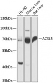 ACSL5 Rabbit pAb (A14130)