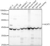 ACAT1 Rabbit pAb (A5335)