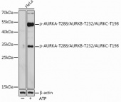 Phospho-AURKA-T288/AURKB-T232/AURKC-T198 Rabbit pAb (AP0948)