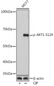 Phospho-AKT1-S124 Rabbit mAb (AP0982)