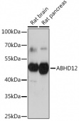 ABHD12 Rabbit pAb (A17678)