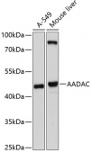 AADAC Rabbit pAb (A10365)