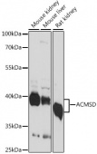ACMSD Rabbit pAb (A15953)
