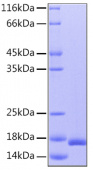 Recombinant Human IL-36Ra/IL-1F5 Protein (RP00030)