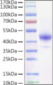 Recombinant Mouse TNFRSF13C/BAFFR/CD268 Protein (RP01493)