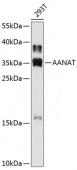 AANAT Rabbit pAb (A11850)
