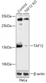[KO Validated] TAF12 Rabbit pAb (A18073)