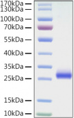 Recombinant Mouse TNFRSF5/CD40 Protein (RP01325)