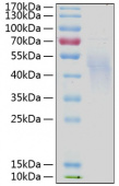 Active Recombinant Human IL-4RA/CD124 Protein (RP00099)
