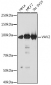 VAV2 Rabbit mAb (A3548)