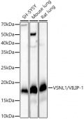 VSNL1/VILIP-1 Rabbit mAb (A22101)