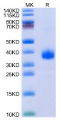 Recombinant SARS-CoV-2 Spike RBD(B.1.640.2/IHU) Protein (RP02104)