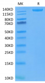 Recombinant SARS-COV-2 Spike S1+S2 ECD(S-ECD)(D614G) Trimer Protein (RP02327)