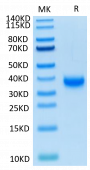 Biotinylated Recombinant SARS-COV-2 Spike RBD  Protein (RP02326)