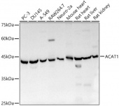 ACAT1 Rabbit pAb (A13273)