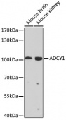 ADCY1 Rabbit pAb (A9760)