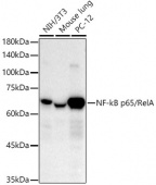 [KO Validated] NF-kB p65/RelA Rabbit mAb (A22331)
