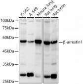 β-arrestin1 Rabbit pAb (A0998)