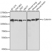 [KO Validated] α-Catenin Rabbit pAb (A5635)
