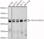 [KD Validated] TSG101/VPS23 Rabbit mAb (A5789)