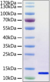 Recombinant SARS-CoV-2 Envelope Protein (RP01263LQ)