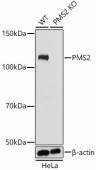 [KO Validated] PMS2 Rabbit pAb (A21547)