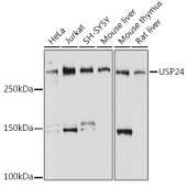 USP24 Rabbit mAb (A0621)