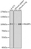 [KO Validated] RALBP1 Rabbit pAb (A1140)