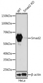 [KD Validated] Smad2 Rabbit mAb (A19114)