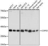 [One Step]COPS5 Antibody Kit (RK05635)