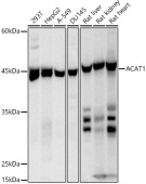 ACAT1 Rabbit mAb (A20943)