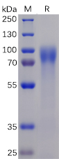 Recombinant Human DNAM-1/CD226 Protein (RP02251)