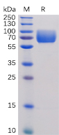Recombinant Human B7-2/CD86 Protein (RP02220)